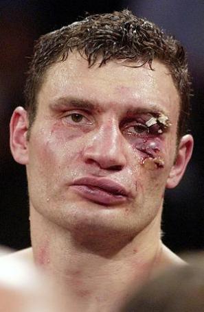 vitali-klitschko35.jpg